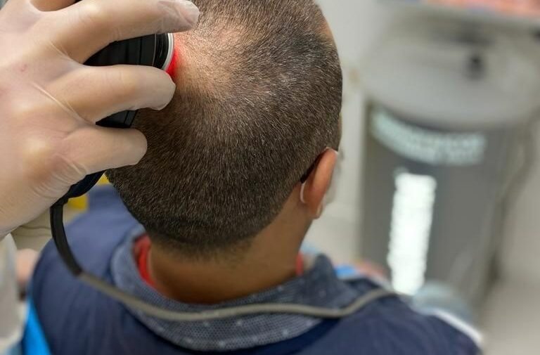 Il check-up del capello con protocollo G+HAIR